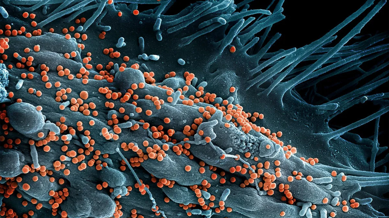 Lujo Virüsü: %80 Ölüm Oranıyla Gizli Tehlike